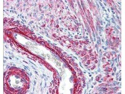 Immunohistochemistry: MRCL3 [p Ser19, p Ser20] Antibody [NB100-1687]